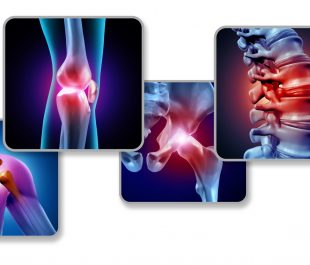 Pain of the joints concept as skeleton and muscle anatomy of the body with a group of sore joints as a painful injury or arthritis illness symbol for health care and medical symptoms with 3D illustration elements.